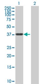 ALDH3B2 Antibody in Western Blot (WB)