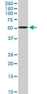 ALDH3A2 Polyclonal Antibody, MaxPab™