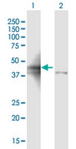 ALDOA Polyclonal Antibody, MaxPab™