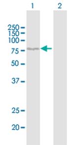 ALOX12 Antibody in Western Blot (WB)