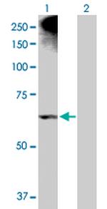 ALOX12 Polyclonal Antibody, MaxPab™