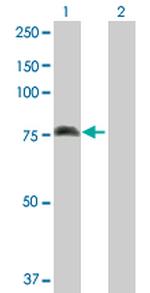ALOX15 Polyclonal Antibody, MaxPab™