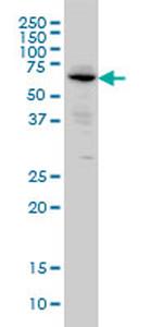 ALPI Monoclonal Antibody (3A8)