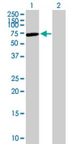 ALPL Antibody in Western Blot (WB)
