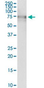ALPL Antibody in Immunoprecipitation (IP)