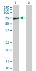 ALPP Antibody in Western Blot (WB)