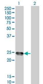 AMELX Monoclonal Antibody (6G3)