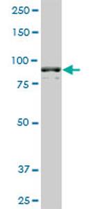 AMPD2 Antibody in Western Blot (WB)