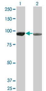 AMPD2 Antibody in Western Blot (WB)