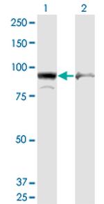 AMPD2 Monoclonal Antibody (6A8)