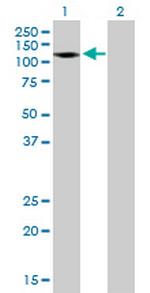 AMPH Polyclonal Antibody, MaxPab™