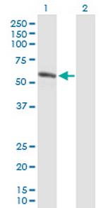 AMY1B Polyclonal Antibody, MaxPab™