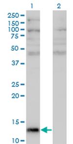 ANG Monoclonal Antibody (2A7)