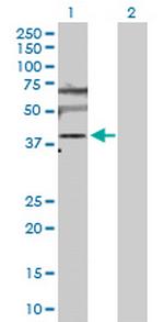 SLC25A6 Polyclonal Antibody, MaxPab™