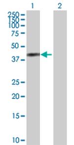 ANXA2 Polyclonal Antibody, MaxPab™