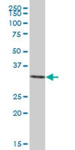 ANXA3 Antibody in Western Blot (WB)