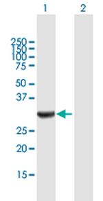 ANXA3 Polyclonal Antibody, MaxPab™