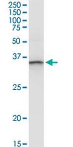 ANXA3 Antibody in Western Blot (WB)