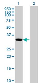 ANXA3 Polyclonal Antibody, MaxPab™