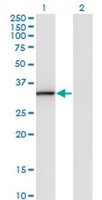 ANXA3 Monoclonal Antibody (1E2)