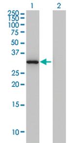 ANXA3 Antibody in Western Blot (WB)