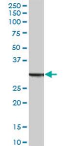 ANXA5 Antibody in Western Blot (WB)