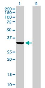 ANXA5 Polyclonal Antibody, MaxPab™