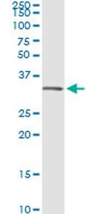 ANXA5 Antibody in Immunoprecipitation (IP)