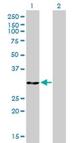 ANXA5 Antibody in Western Blot (WB)