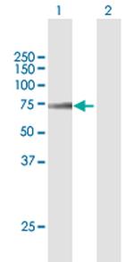 AOAH Polyclonal Antibody, MaxPab™