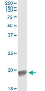 BIRC5 Antibody in Immunoprecipitation (IP)