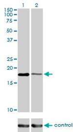 BIRC5 Antibody in Western Blot (WB)