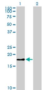 BIRC5 Antibody in Western Blot (WB)