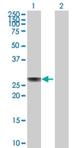 APOA1 Polyclonal Antibody, MaxPab™