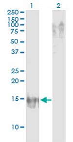 APOB Monoclonal Antibody (3E5)