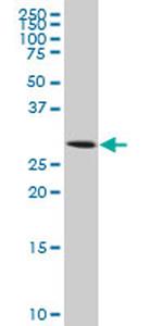 AQP8 Antibody in Western Blot (WB)