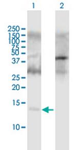 APOC2 Polyclonal Antibody, MaxPab™