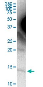 APOC4 Antibody in Western Blot (WB)
