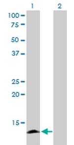 APOC4 Antibody in Western Blot (WB)