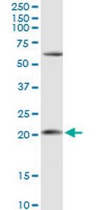 APRT Polyclonal Antibody, MaxPab™