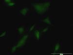 KLK3 Monoclonal Antibody (1B1)