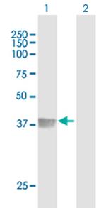FAS Antibody in Western Blot (WB)
