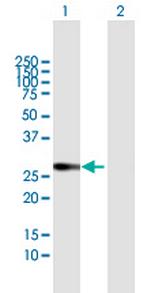 AQP1 Polyclonal Antibody, MaxPab™