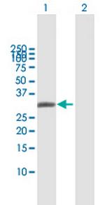 AQP7 Polyclonal Antibody, MaxPab™