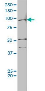 AR Monoclonal Antibody (1G3)