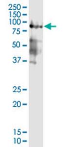AR Monoclonal Antibody (3D10)