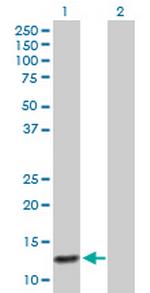 ABCC6 Polyclonal Antibody, MaxPab™
