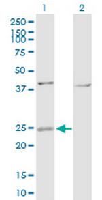 ARL4D Polyclonal Antibody, MaxPab™