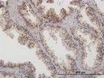 ARG2 Polyclonal Antibody, MaxPab™