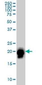 RHOA Monoclonal Antibody (1A11)